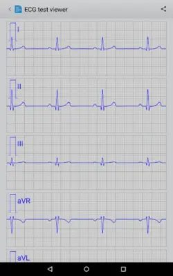 Istel ECG android App screenshot 0