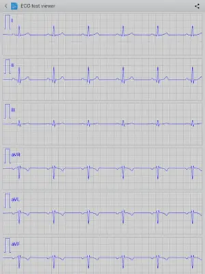 Istel ECG android App screenshot 1