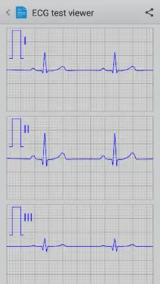 Istel ECG android App screenshot 2