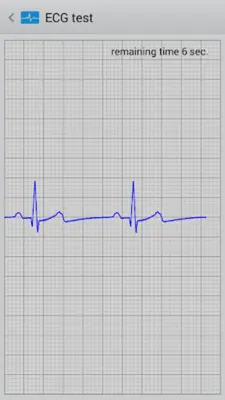 Istel ECG android App screenshot 3